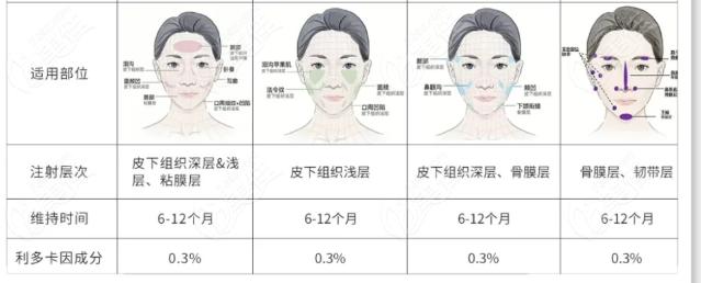 润致玻尿酸型号与适用部位一览表