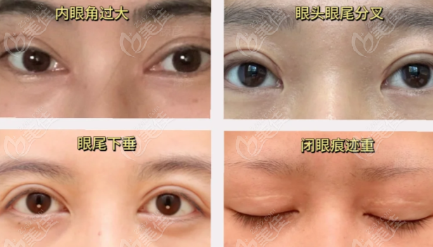 廣州呂方中眼修復(fù)價(jià)格 廣州呂方中眼修復(fù)價(jià)格