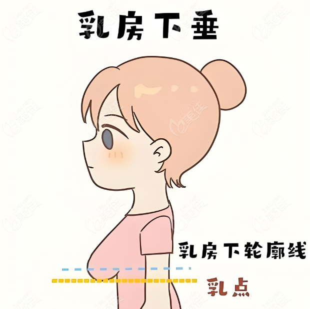 北京胸部懸吊提升做得好的醫院