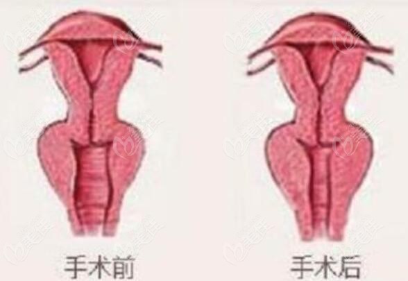 重庆做女性阴道紧缩整形好的医院排行榜前推荐！星荣靠实力上榜，网友力荐！