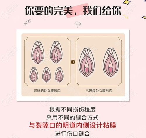 武漢處修手術(shù)哪個醫(yī)院好