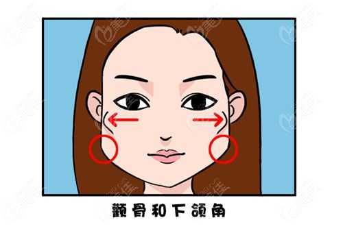 赵贵庆做颧骨内推无失败实例