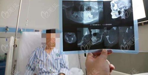 赵贵庆医生为何没有失败实例