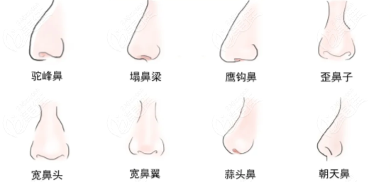 靳玉彪野生实例