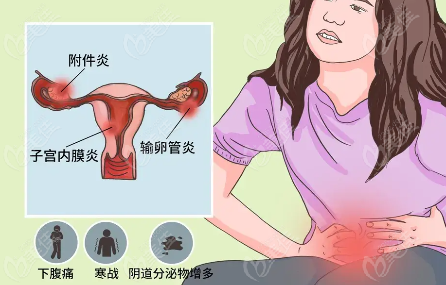 妇科私密医院在线24小时免费问诊常见问题及答案