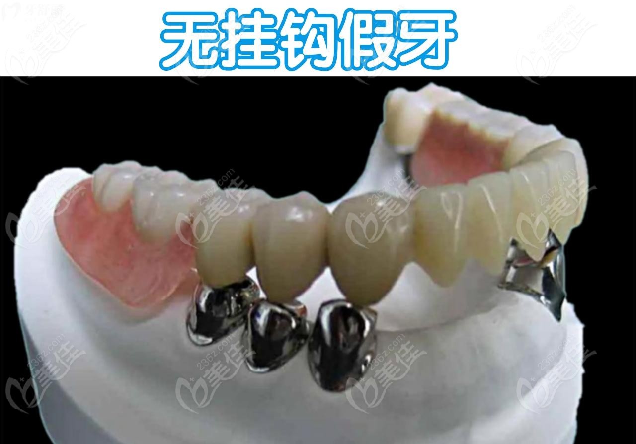 无挂钩假牙www.236z.com