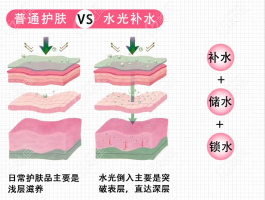 海月兰水光成效怎么样 海月兰水光成效怎么样