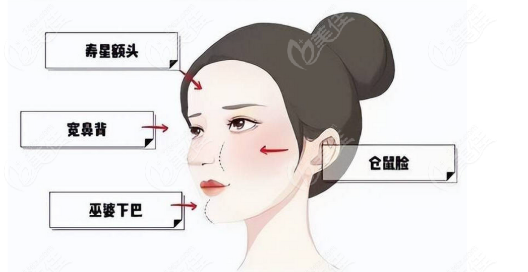 北京馒化脸修复医院脸部馒头化修复强 m.236z.com