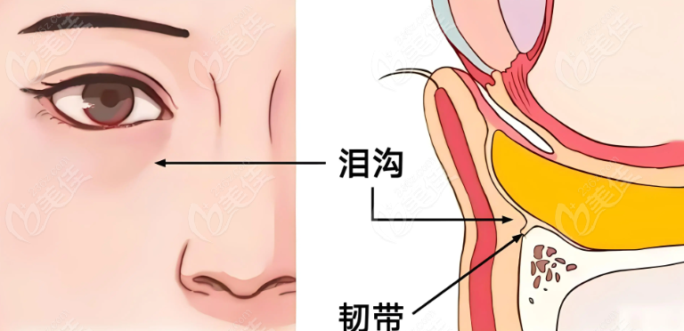 深圳朱冠峰不開刀去眼袋真的么？