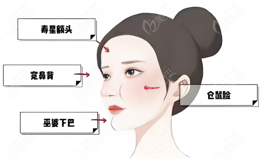 生长因子馒化修复价格表
