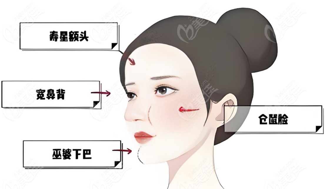 女巫下巴馒化怎么办？