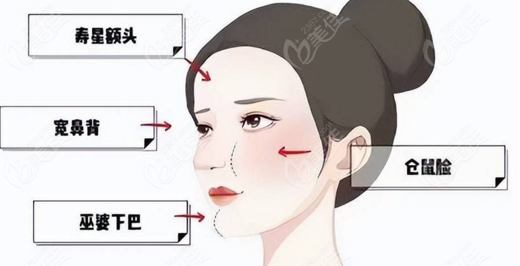 脸部馒头化发泡怎么修复轻薄紧致?我用了5种方法解决玻尿酸导致的面部馒化