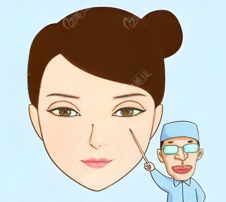 北京下眼睑修复好的医生排名前十修复下眼睑好
