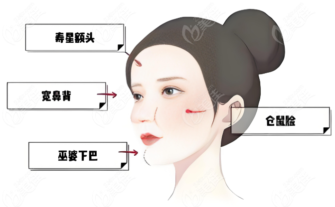 北京王东馒化修复好 美佳网