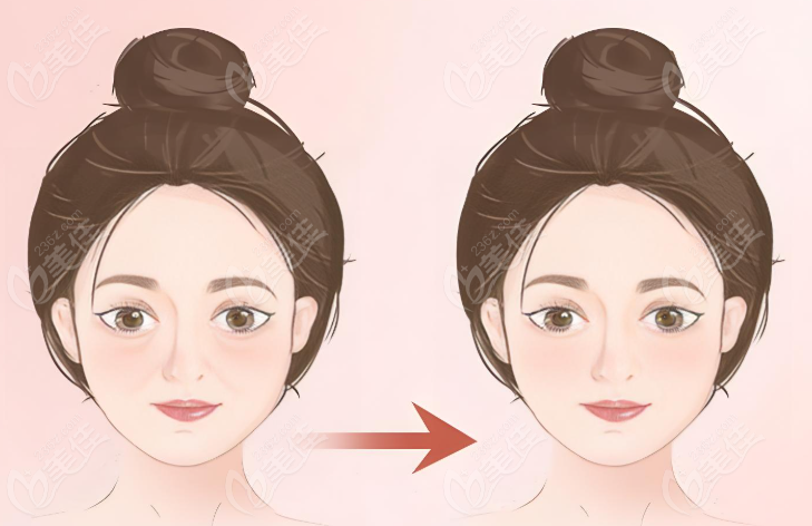 王东馒化脸修复真的好