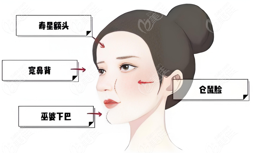 钟杰光医生口碑很差？