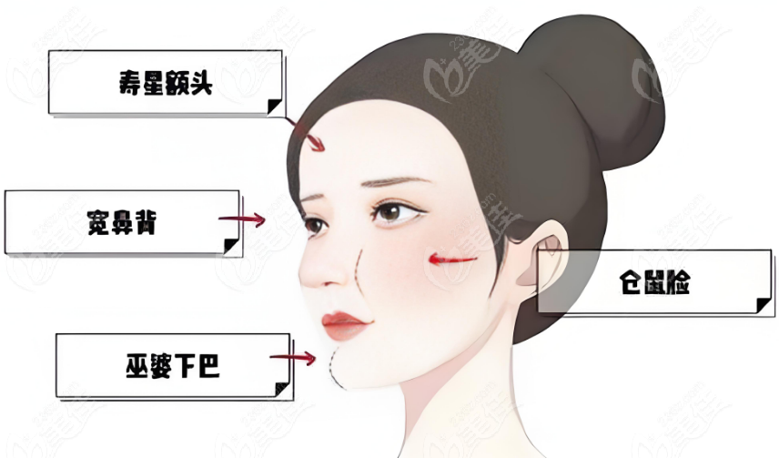 面部轻薄紧致做什么项目