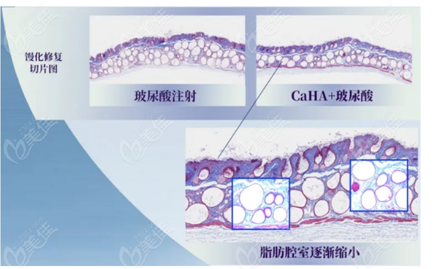 海魅云镜和海魅月白该如何选