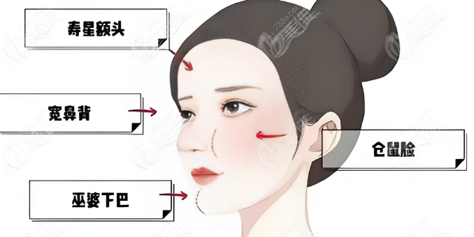 鐘杰光修復(fù)如何