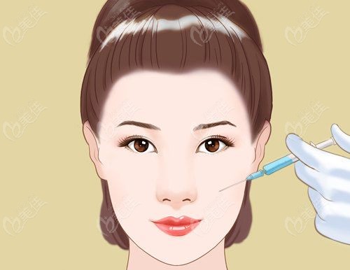 武汉美莱祝栋医生注射实例