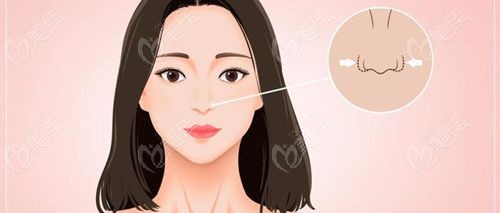 周柯在成都隆鼻出名的醫(yī)生中排名前三