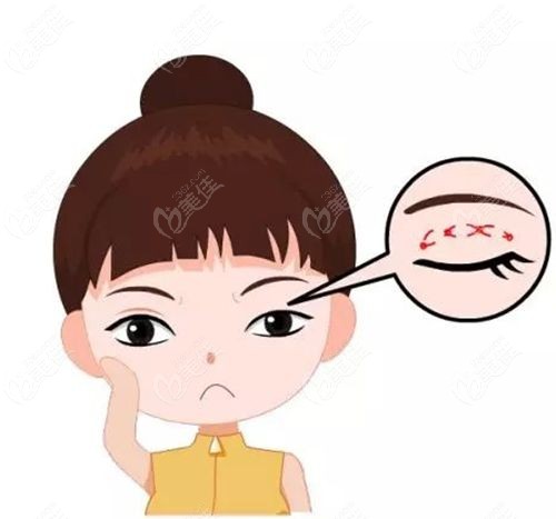 成都杨迪双眼皮修复价格