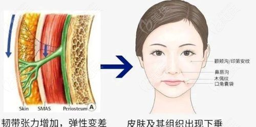 乔雅登丰颜不会馒化
