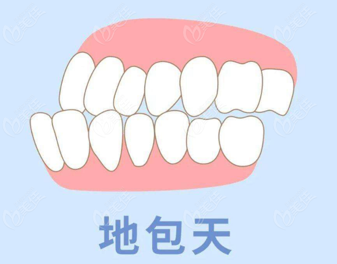 2025地包天矯正價格表