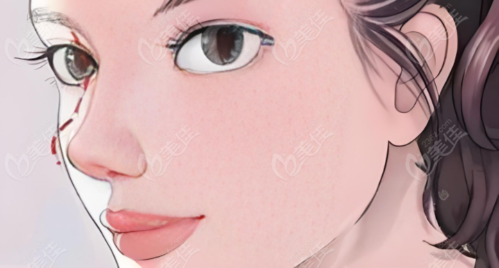 龚涛做的鼻子好看