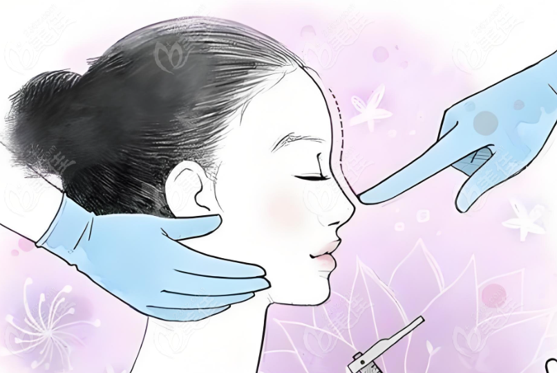 乌鲁木齐隆鼻好的医生排名前五www.236z.com
