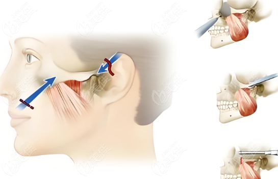 重慶磨骨有資質(zhì)的5大醫(yī)院醫(yī)生排名名單