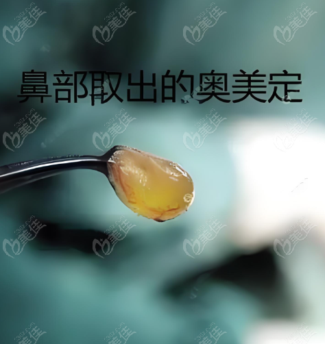 取注射異物哪里醫(yī)院可以做m.xqnp.cn
