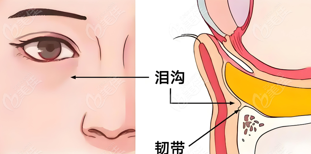 师丽丽眼袋修复卧蚕真的好不返修