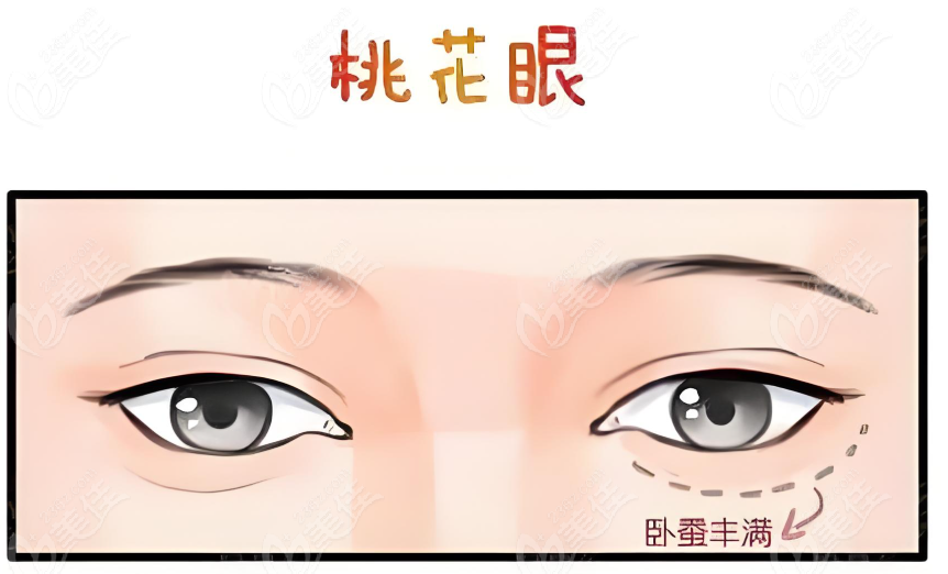 师丽丽医生眼袋卧蚕真实实例分享www.236z.com