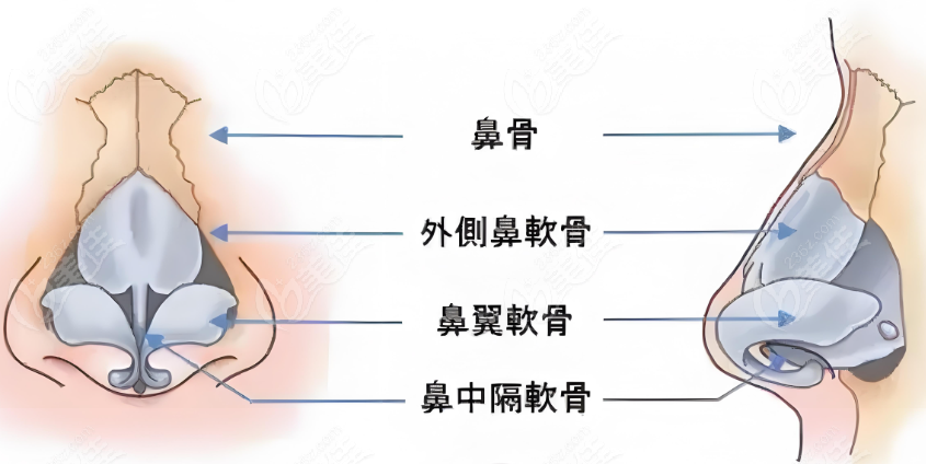 隆鼻手术