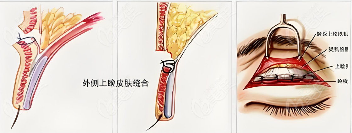 呂方中醫(yī)生眼修復(fù)名聲真實嗎