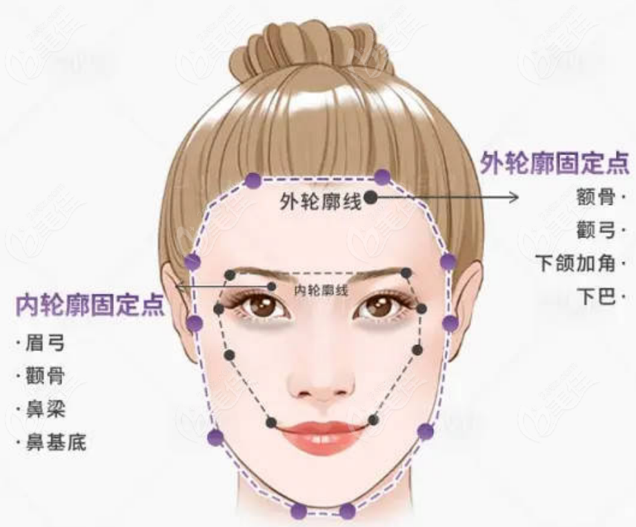 236z.com幼態臉整形手術
