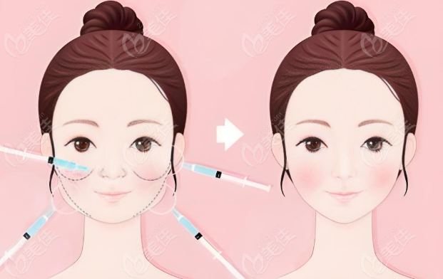 冭活泡泡针前后对比照