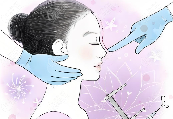 自体软骨隆鼻手术真实实例分享www.236z.com