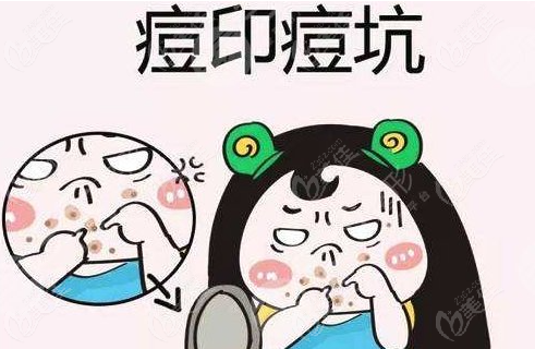 点阵激光去痘坑价格在1500-5000元起