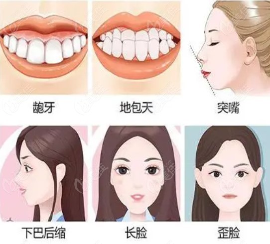 双鄂手术适合人群 m.236z.com