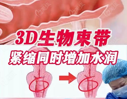 3D生物束带紧缩术真的有成效吗