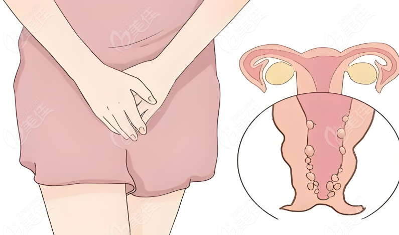 补处女膜多少钱？