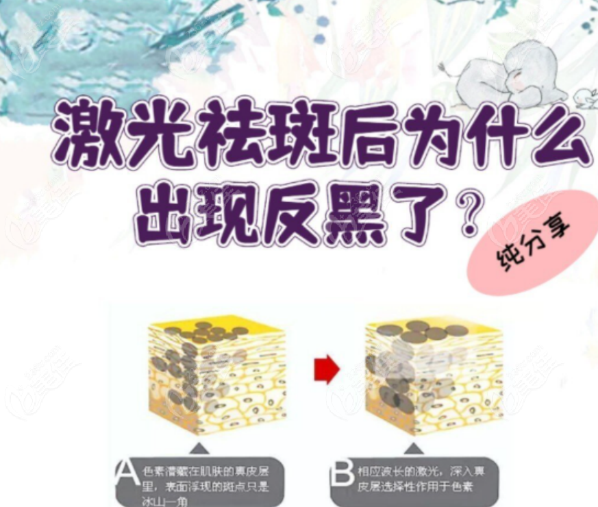 236z.com激光祛斑