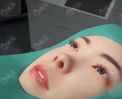 隆鼻手术