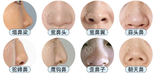 周顺波做鼻子好看