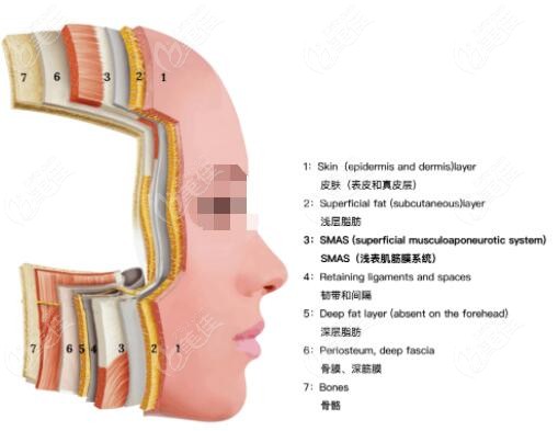 松垂脸面部提升为什么大家都建议筋膜提升？筋膜提升几年后会更老吗？