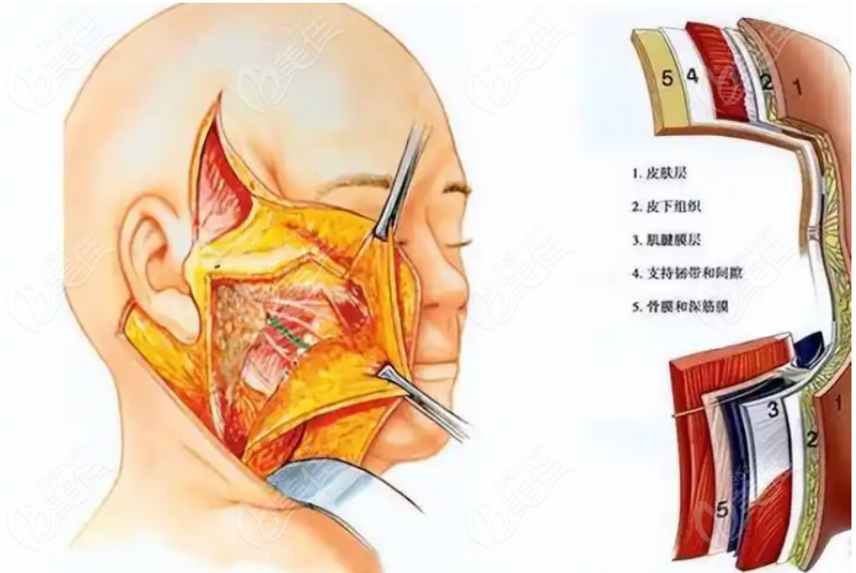 广州拉皮医生排名