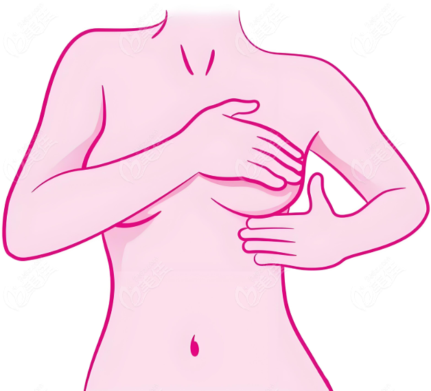 女性乳房整形