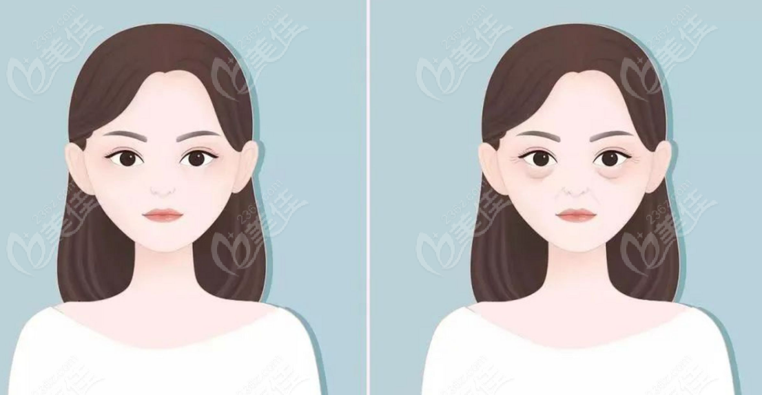 上海美诗沁去眼袋成效好，靠谱